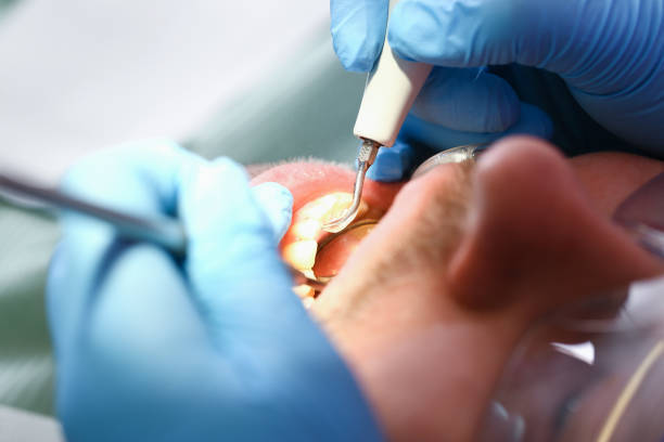 Best Chipped Tooth Repair Near Me  in Lexington, TN