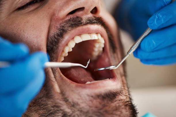Best Urgent Tooth Repair  in Lexington, TN