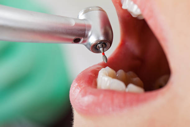Best Cracked Tooth Emergency Dentist  in Lexington, TN